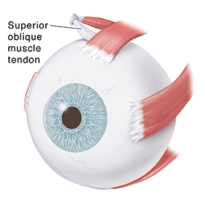 Three-quarter view of eye showing eye muscles.