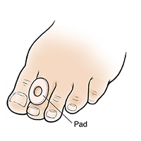 Foot with pad on seond toe.