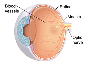 Three quarter view of cross-sectioned eye showing normal anatomy.