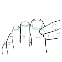 Fingers beginning to touch the edges of each toenail on one foot.