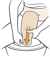 Person sitting on toilet emptying ostomy pouch into toilet.