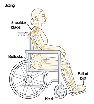 Outline of person sitting in wheelchair with bones visible. Pressure points: Shoulder blade, buttocks, ball of foot, heel.
