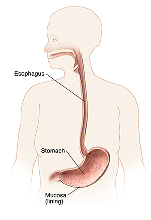 Outline of woman showing mouth, esophagus, and stomach.