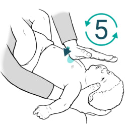 Adult holding baby face-up on forearm, with heel of hand pushing just below nipple line.