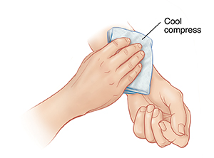 Hand placing cool compress on skin.