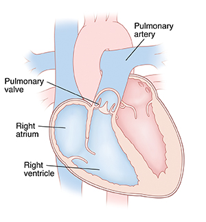 Cross section of heart showing pulmonary artery, pulmonary valve, right atrium and right ventricle.