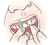 Closeup of mouth showing hands flossing between front teeth.