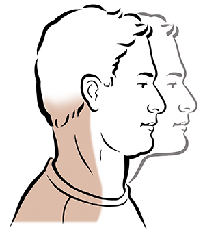 Side view of man's head showing two positions of chin tuck exercise. 