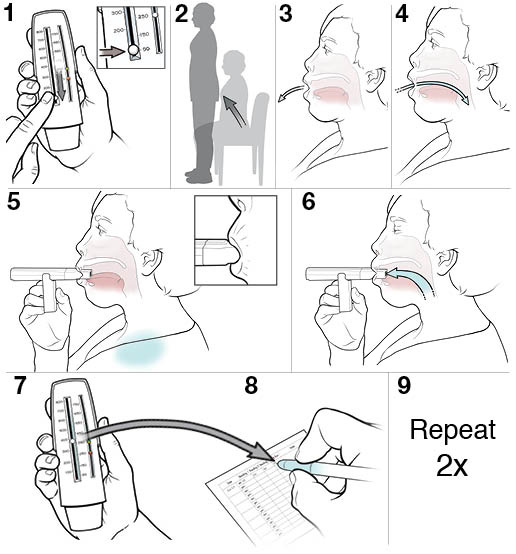 9 steps for using a peak flow meter