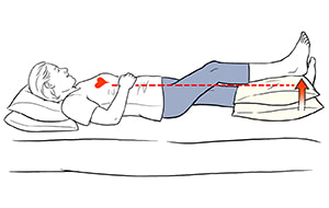 Person lying on back using two pillows under calf to raise injured leg higher than heart.