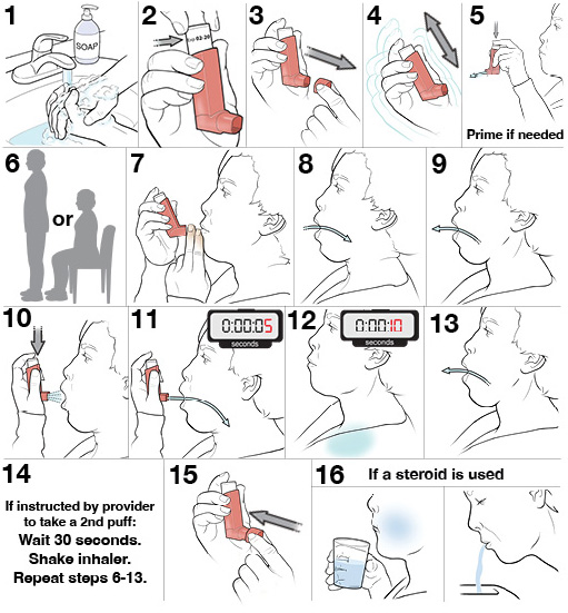 16 steps for using a Metered Dose Inhaler Without a Spacer