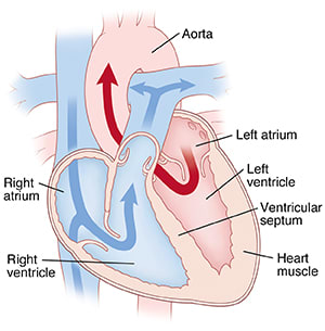 Cross section of normal heart showing blood flow through atria and ventricles.