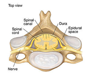 Top view of cervical vertebra showing spinal cord, dura, and epidural space.