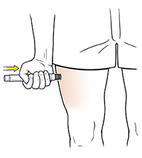 Hand pressing epinephrine autoinjector to side of thigh.