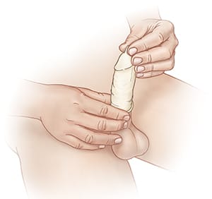 Man putting condom on penis.