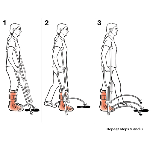 3 steps in using crutches with step through.