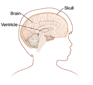 Outline of boy's head in profile showing brain and skull in cross section.