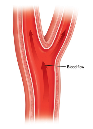 Cross section of healthy carotid artery showing blood flow. 