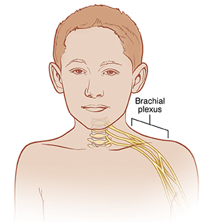 Front view of boy's head and shoulders showing brachial plexus.