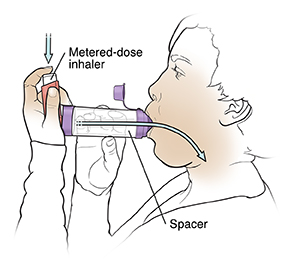 Person using metered-dose inhaler with spacer.