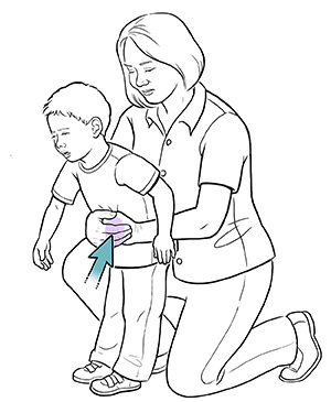 Mujer haciendo la maniobra de salvamento por atragantamiento en un niño pequeño.