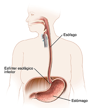 Vista frontal de una figura humana en la que pueden verse el esófago y el esfínter esofágico inferior.