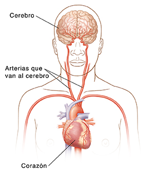 Vista frontal de la cabeza y la parte superior del cuerpo en donde pueden verse las arterias carótidas, el corazón y el cerebro.