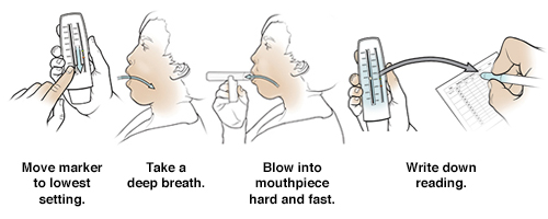 5 steps in using a peak flow meter.