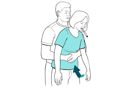 Man giving abdominal thrusts to woman, showing object coming out of mouth.