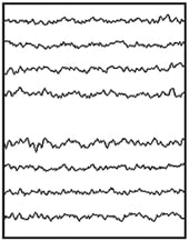 Normal EEG tracing.